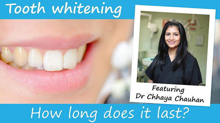 How long do crest white strips last before they expire