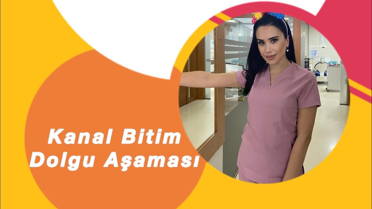 Kanal tedavisi bitim aşaması KANAL DOLUM #dolgu