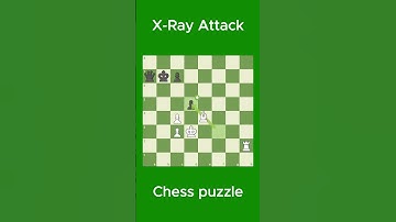X-Ray Attack  | Subscribe for Daily Chess Puzzle