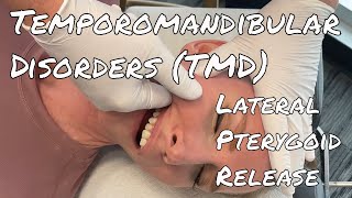 TMD/TMJ Pain - MSR Lateral Pterygoid Release