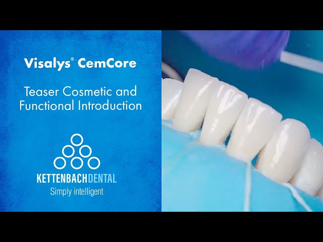 Visalys® CemCore Facings - Cosmetic and Functional Introduction (Teaser)
