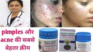 Kalonji pimples acne Cream। Remove Pimples। Acne Cream For spotless Skin