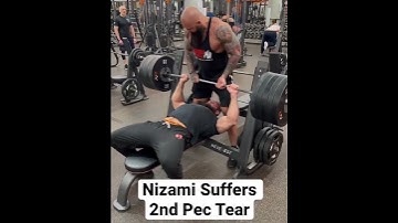 Nizami Tagiev Tears Pec