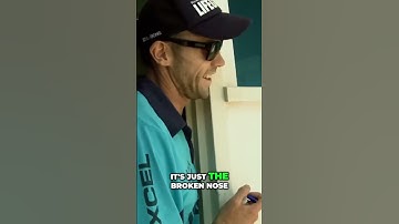 Broken nose or a nose Job? #shorts  #bondibeach #bondirescue