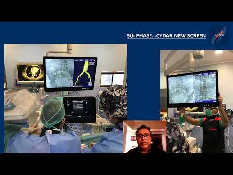 Applications and installation of Artificial Intelligence in a non-hybrid operating room.