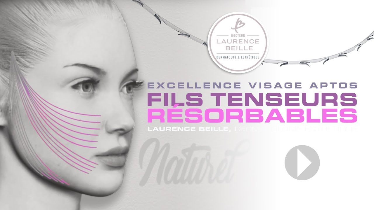 Les fils tenseurs résorbables Excellence Aptos