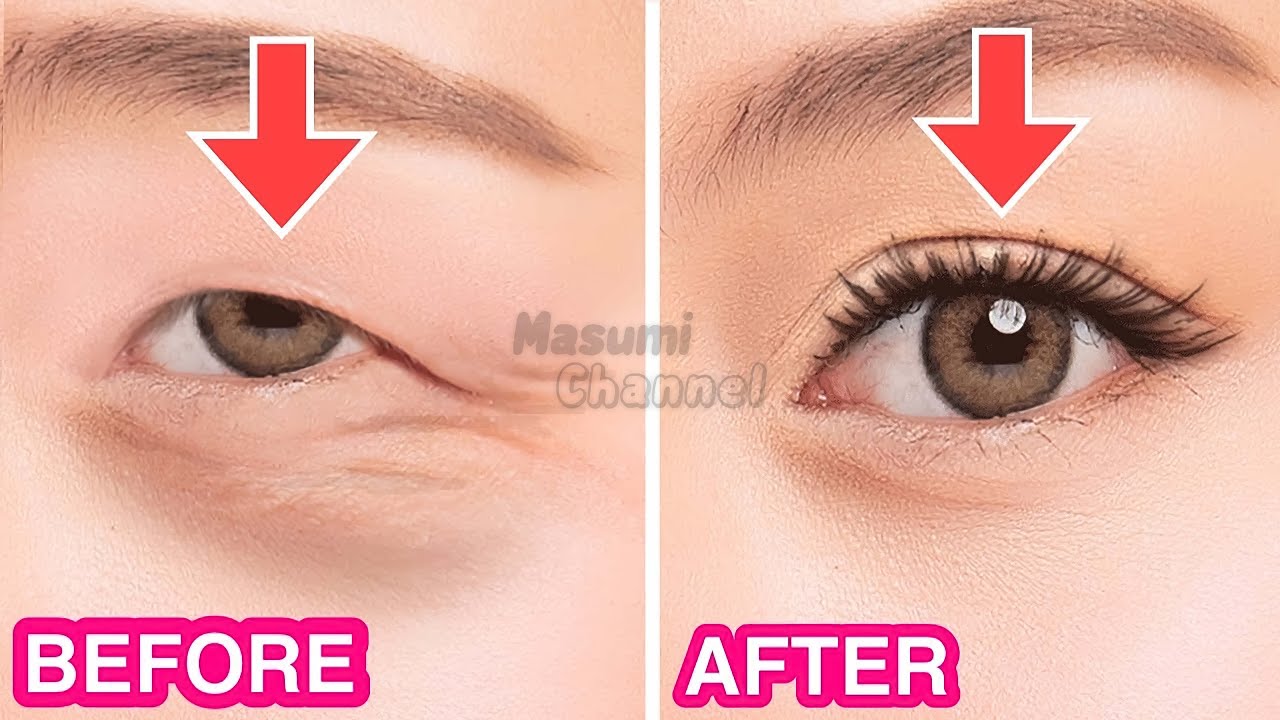 Big Eye Exercise! Create Double Eyelid Without Surgery | Make Your Eyes Bigger Naturally