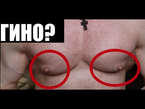 Как я стал обладателем гинекомастии и почему я не удаляю свое гино #shorts