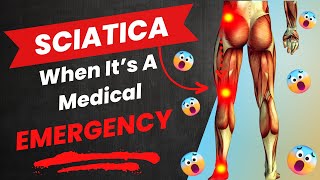 Wrong Type Of Sciatica = Paralysis! (Cauda Equina Syndrome)