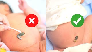 Easy Newborn Umbilical Cord Care