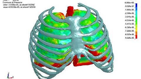 LS-DYNA Examples - Smoker’s lung during breathing