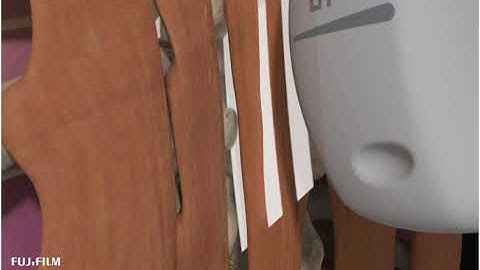 How to: ERECTOR SPINAE BLOCK 3D VIDEO