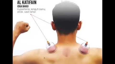 TITIK BEKAM SUNNAH RASULULLAH