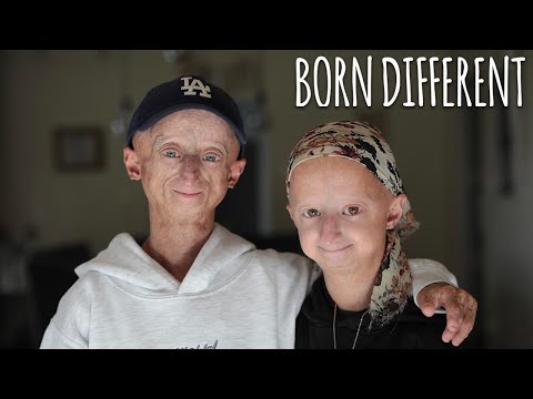 The People Who Age Too Fast BORN DIFFERENT
