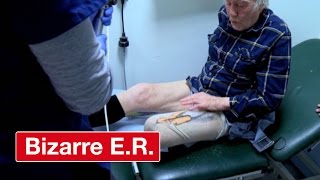 Cutting A Man Out Of His Prosthetic Leg - Bizarre ER