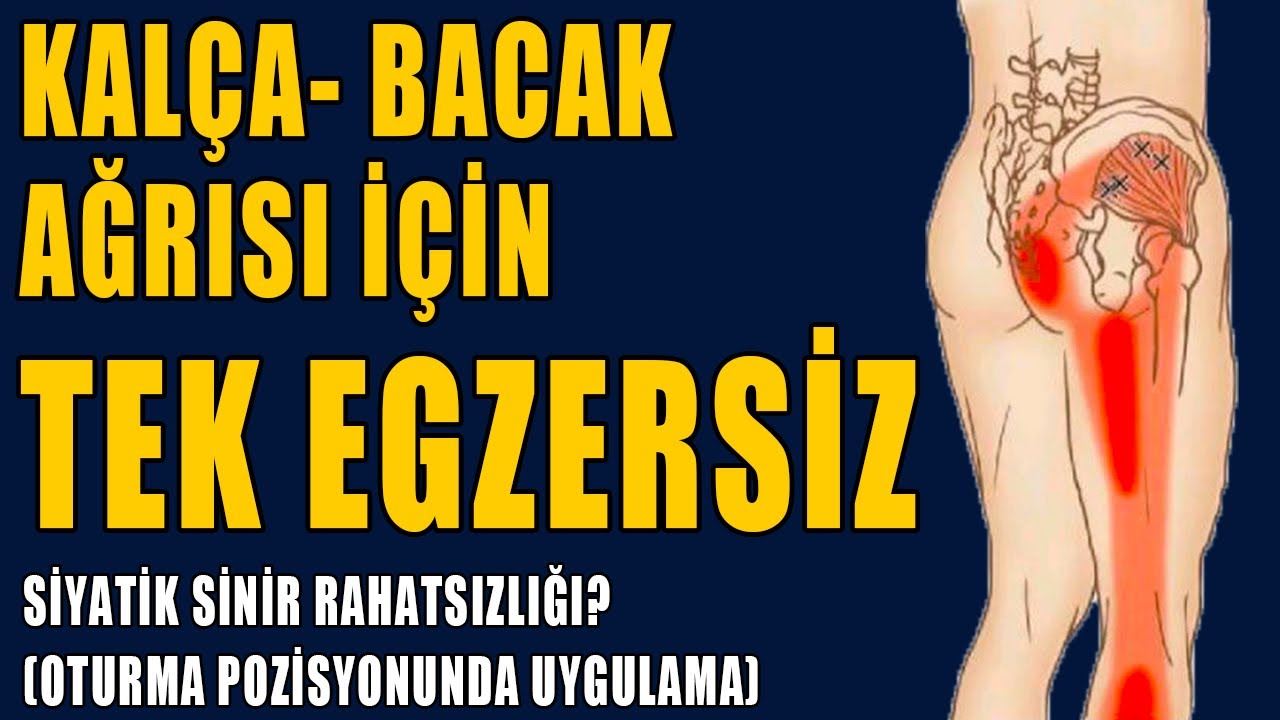 SİYATİK AĞRISI İÇİN TEK EGZERSİZ #aktifizyo #fiziktedavi #siyatik #belağrısı