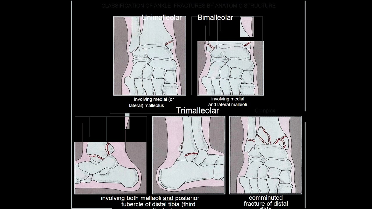 dpt 6820 ankle foot 1