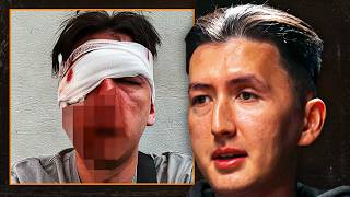 Antifa SMASHED His Face and Left Him With PERMANENT Nerve Damage | Wesley Winter