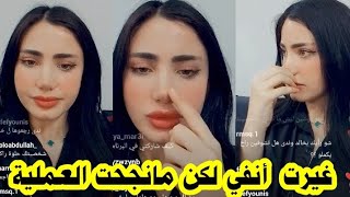 روشين تحكي عن عمليات التجميل اللي خضعت لها وعلاقتها بفريق قسمة ونصيب