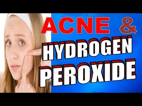  SIMPLE STEPS for using HYDROGEN PEROXIDE for ACNE