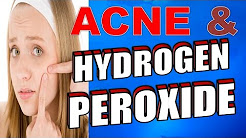 6 SIMPLE STEPS for using HYDROGEN PEROXIDE for ACNE