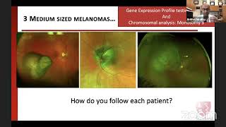 Ask the Expert - Standards of Care for Ocular Melanoma