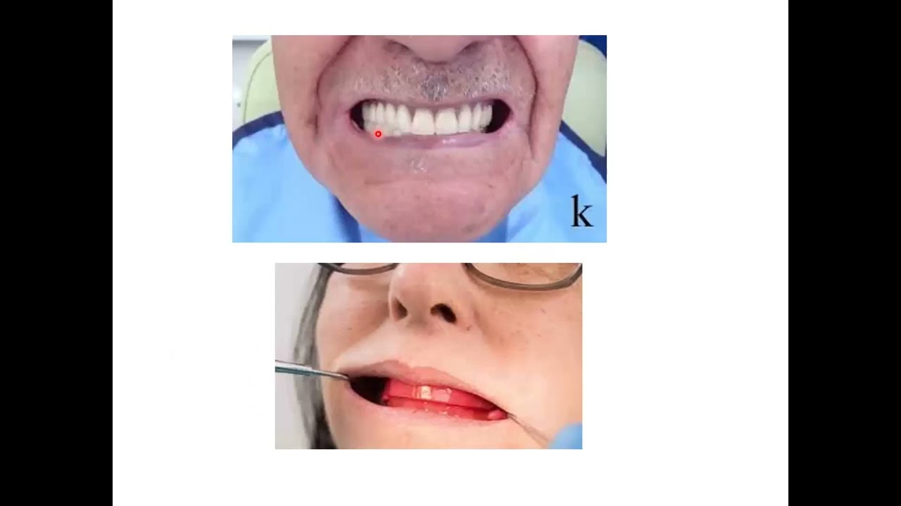 Generalidades de la anatomía parte 3 y clase de ANGLE tema 2