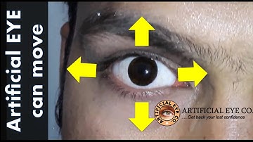 Can artificial eye have movement when I see right or left ?