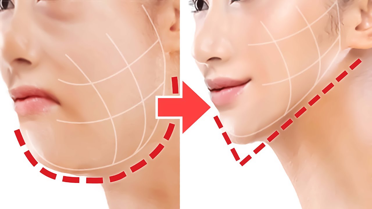 Face Lifting Exercise For JAWLINE, V-Shaped, Sagging Jowls, Cheeks! Look 10Years Younger, Anti-Aging