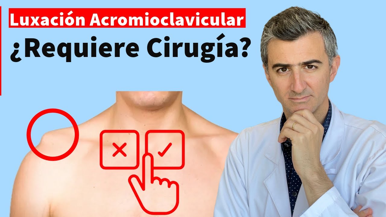 Luxación Acromioclavicular Grado 3: La guía definitiva para tu Recuperación