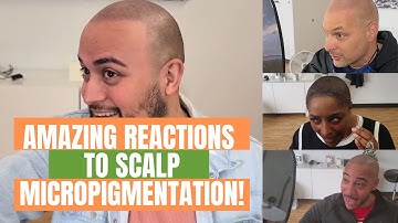 MUST WATCH Best Scalp Micropigmentation  Results in Houston, Texas SMP