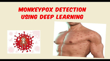 Monkeypox Disease Detection Using Deep Learning