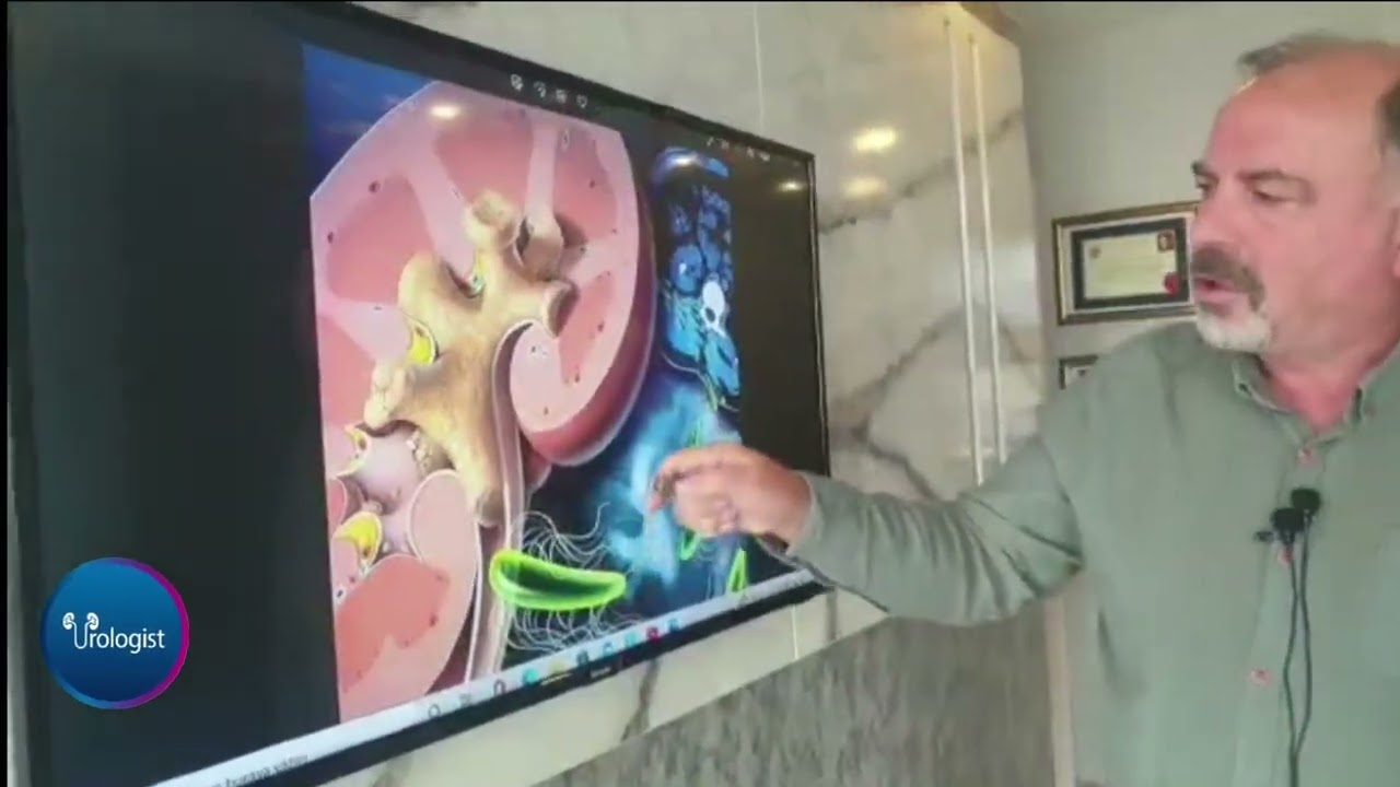 BÖBREK TAŞLARINDA NE ZAMAN AÇIK AMELİYAT GEREKİR?