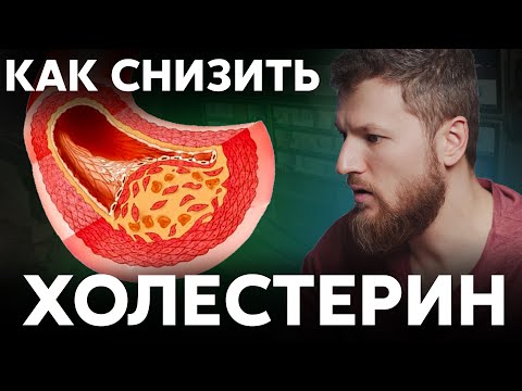 Как снизить ХОЛЕСТЕРИН, избавляемся от атероскероза