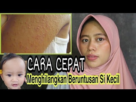 Video: Bintik-bintik kasar di tubuh anak