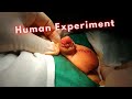 Top 10 of the most disturbing human experiments in history  the unknown