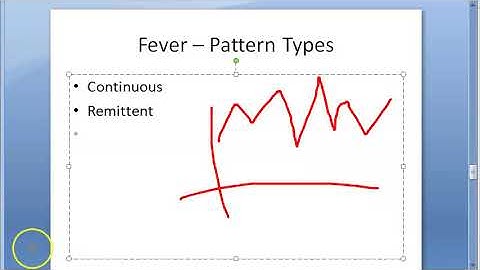 Medicine 096 What is Fever Define Definition Types body temperature normal level Pyrogens Pattern