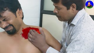 Amazing Chiropractic Adjustment India | Collar Bone Fracture Treatment By Indian Chiropractor Video