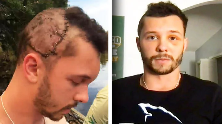 Diver Survives Alligator Bite That Fractured His S...