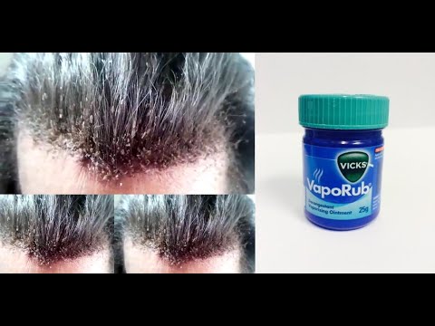 Video: Vicks AntiGripp COMPLEX - Instructions For Use, Price, Reviews, Composition