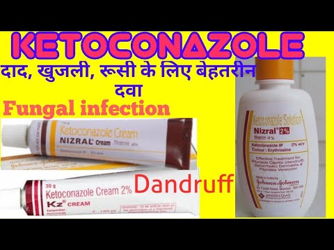 how to use ketoconazole cream for tinea versicolor