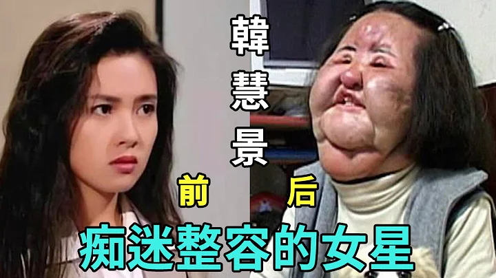 明明是大美人，却非要整容成「僵尸脸」，不知道这些女星照镜子的时候，有没有后悔？#邵音音#韩慧景#郑裕玲#杨怡#傅明宪#邵音音#李嘉欣#李彩桦#黎姿#薛芷伦#郭可盈#杨丽菁 - 天天要闻