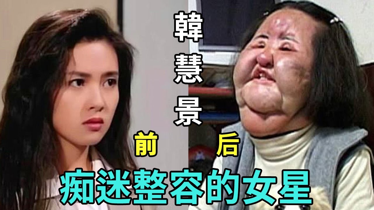 明明是大美人,卻非要整容成「僵屍臉」,不知道這些女星照鏡子的時候,有沒有後悔?#邵音音#韓慧景#鄭裕玲#楊怡#傅明憲#邵音音#李嘉欣#李彩樺#黎姿#薛芷倫#郭可盈#楊麗菁