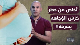 لن تتخلص من كرش الوجاهه اذا لم تلتزم بالخطوات التالية ومعرفة السبب!! | صحة بلس