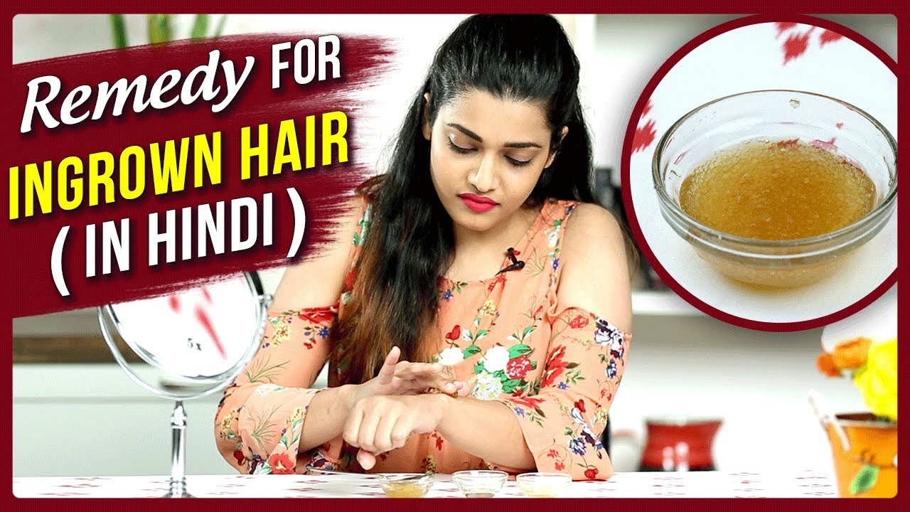 Ingrown Hair Removal At Home | Remedy For Ingrown Hair In Hindi | DIY | Ingrown  Hair Treatment - thptnganamst.edu.vn