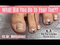 👣Its Mr. Meticulous!! - How to Pedicure an Ingrown & Impacted Toenail Pain👣