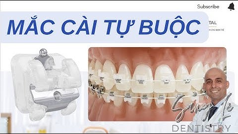 Tối Ưu Hóa Cơ Sinh Học Trên Hệ Thống Mắc Cài Sứ Tự Buộc | Dr. Rodrigo de Pozo #3M