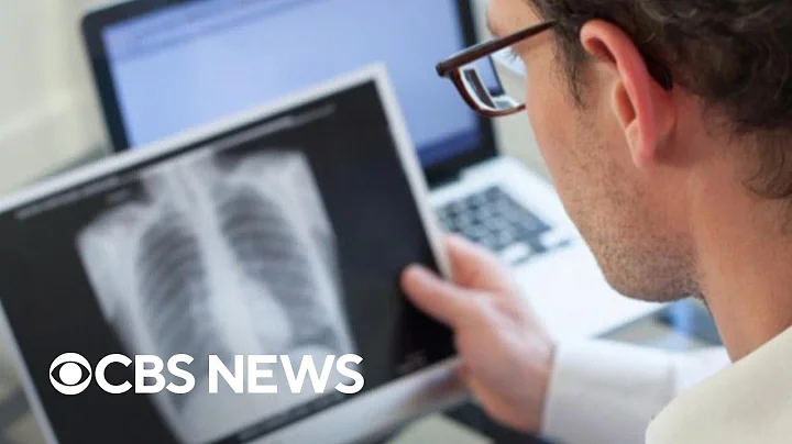 Kansas faces record tuberculosis outbreak