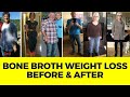 Bone Broth Weight Loss Before and After