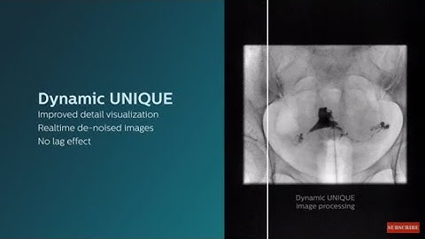 Philips Dynamic UNIQUE Fluoroscopy Solution Animation Video